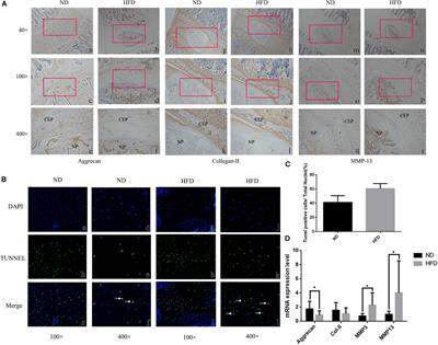 Obesity Mediates Apoptosis and Extracellular Matrix Metabolic Imbalances via MAPK Pathway Activation in Intervertebral Disk Degeneration